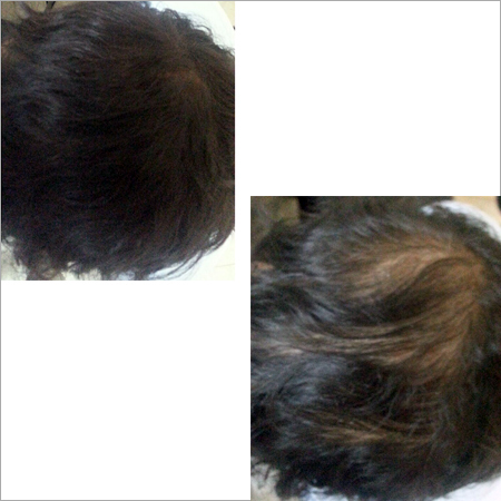 Hair Fibres