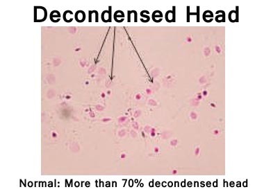 Nuclear Chromatin Decondensation (N.C.D.)