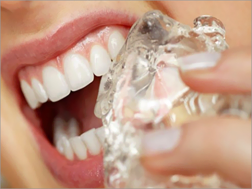 Teeth And Gums Reveal