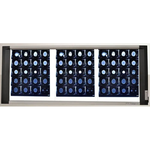 Led X-Ray View Box With Digital Dimmer - Darkness Range: >10000