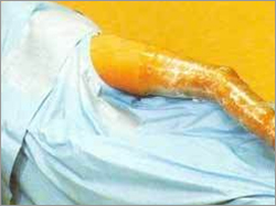 Medical Disposal Drapes & Dressings