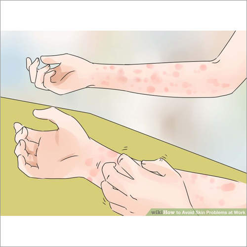 anti allergy tablets
