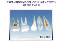 Expansion model of human teeth