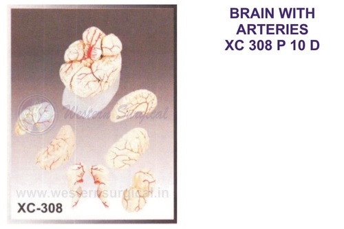 Brain With Arteries