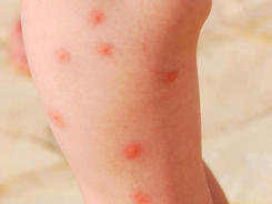 Insects repellent cream