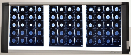 Triple LED X Ray Medical View Box , X-Ray Film Viewer , X-Ray Viewing Box at Cheap Price