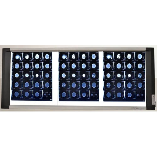 Triple Led X-ray View Box With Digital Dimmer Technology Darkness Range: >10000