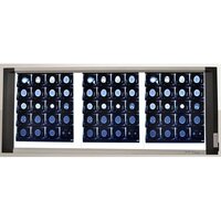 Triple Led X-ray View Box With Digital Dimmer Technology - Darkness Range: >10000