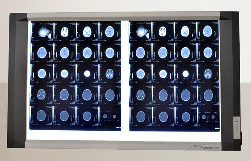 Advance LED X-Ray illuminator Viewing Box