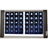 Advance Led X-ray Illuminator Viewing Box - Darkness Range: >6500k