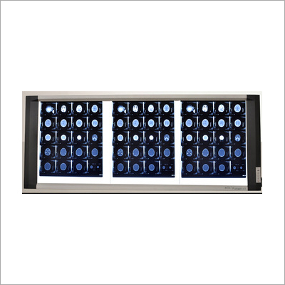 X Ray Film Viewer with Unparalleled Latest LED Technology