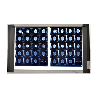 100% Safe Result Oriented LED X-ray Viewer