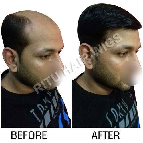 Hair Weaving Shop Centre In Noida in Pul Bangash, Delhi - Ritu Hair Wigs Hair Weaving Shop Centre In Noida in Pul Bangash, Delhi - Ritu Hair Wigs
