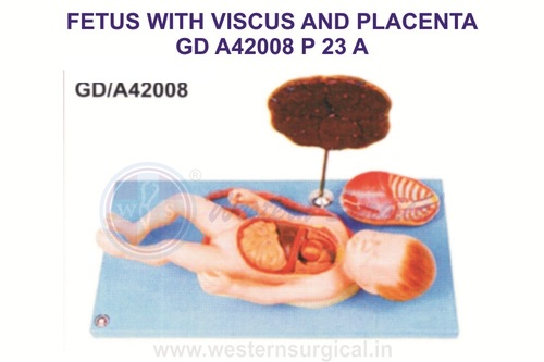 fetus with viscera and placenta