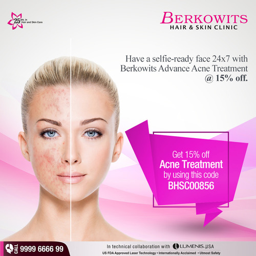 Acne Treatment