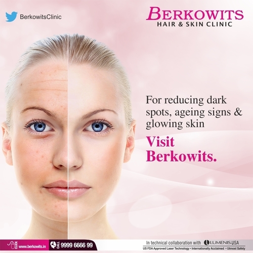 Filament -Grey Hair (E)