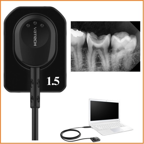 Dental Imaging Intra Oral Sensor