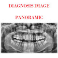 Dental 2D Imaging  Pax-I