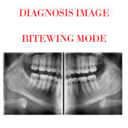 Dental 2D Imaging  Pax-I