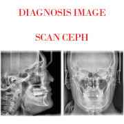 Dental 2D Imaging Pax-I SC