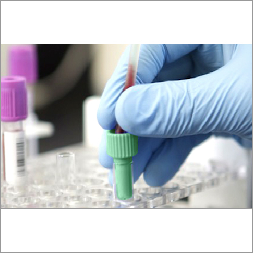 Segement Sampling Device for Blood Bank