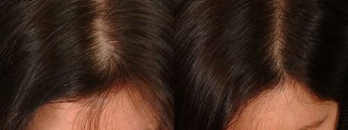 Where to Buy Good Hair Wigs at Best Price in Ashok Nagar, Delhi-110096, India
