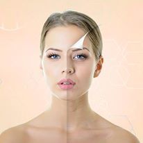 Collagen Remodeling Services
