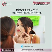 Acne Treatment