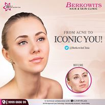 Acne Treatment