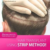Scalp Care Services