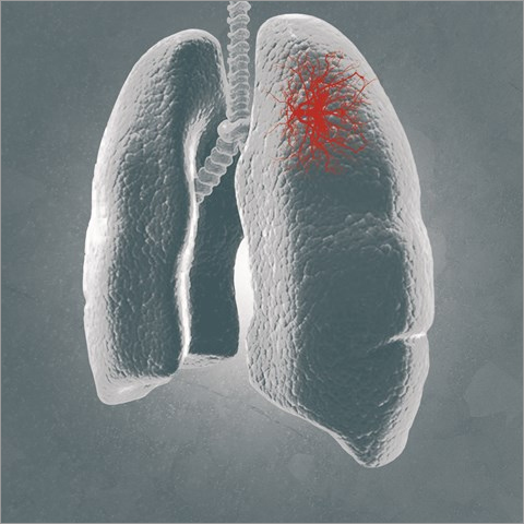 FTD Respiratory pathogens 21