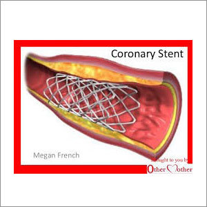 Coronary Stent
