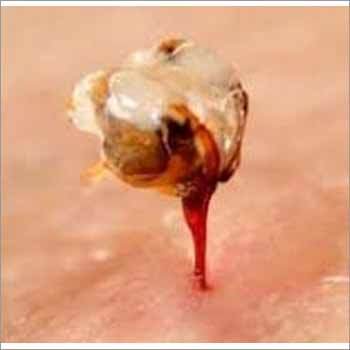Bee Stings Venom
