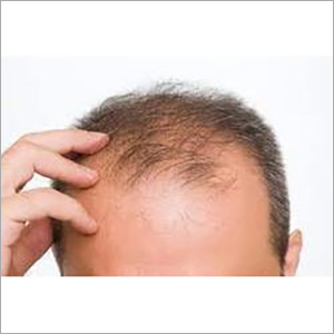 Hair Loss Control Clinic