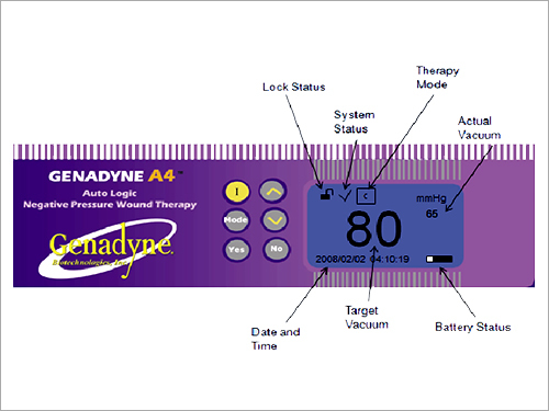 Negative Pressure Wound Therapy System