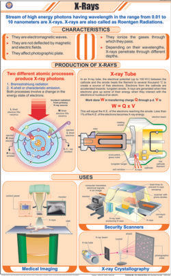 X-Ray Chart