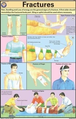 First Aid Charts