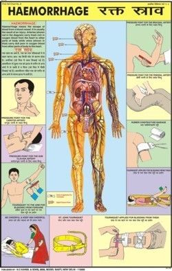 Haemmorhage Chart