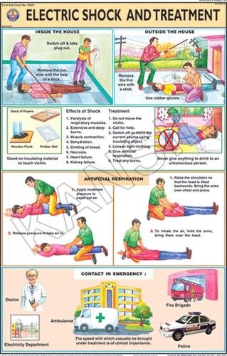 Electric Shock Treatment Chart