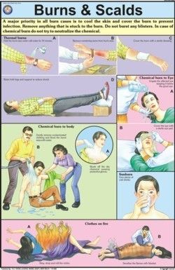 Burns & Scalds Chart