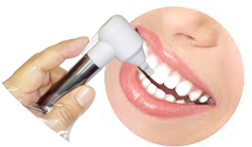 Electric Toothbrush