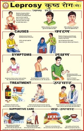 Leprosy Chart