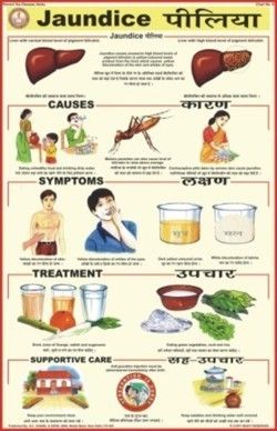 Jaundice Chart