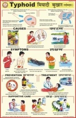 Typhoid Chart