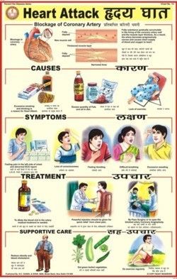 Heart Attack Chart