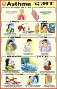 Asthma Chart