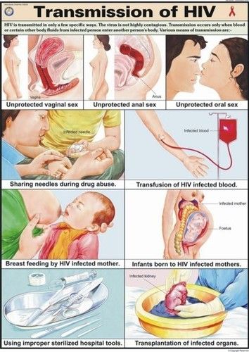 Transmission of HIV Chart