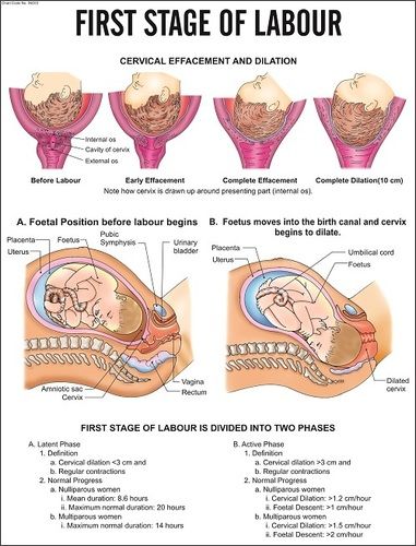 First Stage of labour Chart