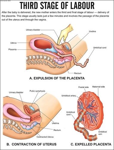 Third Stage of labour Chart