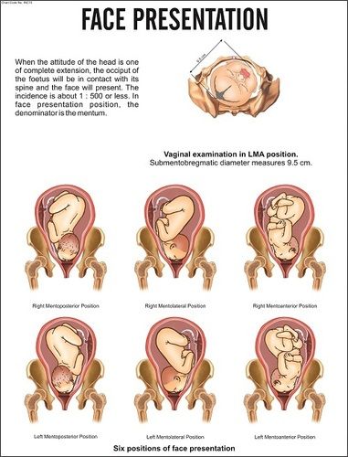 Face Presentation Chart